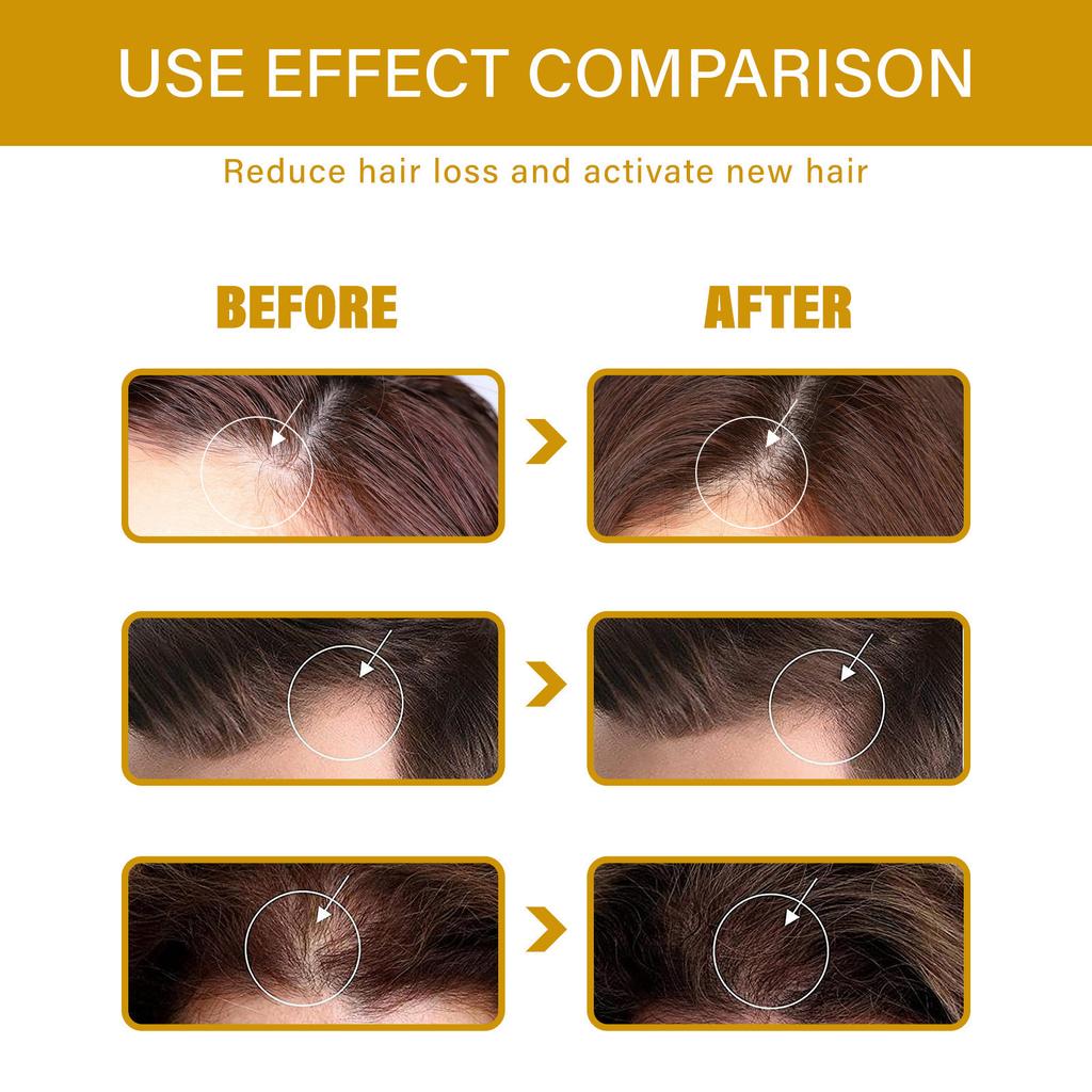 Biotin Hair Growth & Thickening Spray for All Hair Types